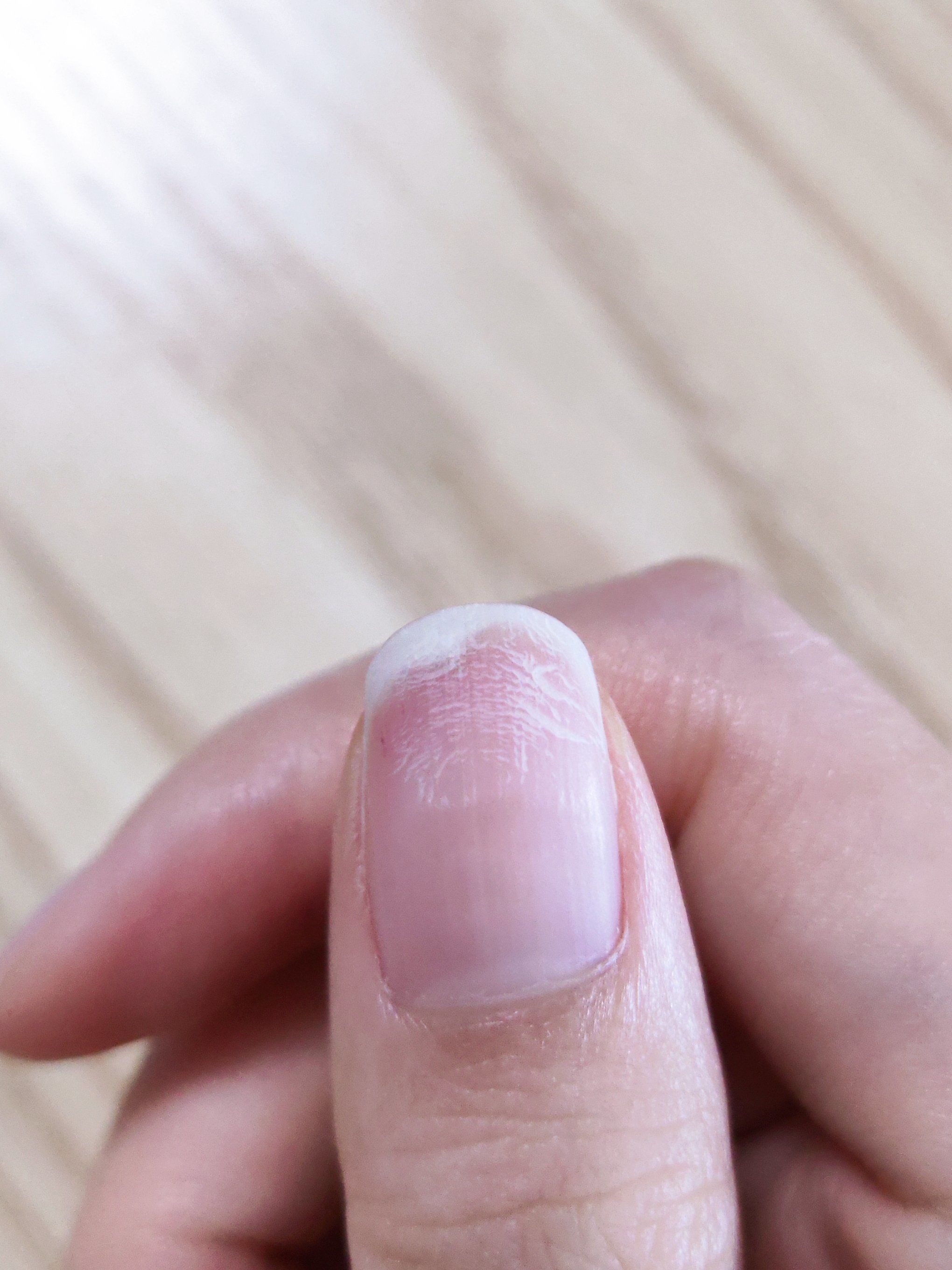 n新手小白一共做了两次美甲,就把指甲造成这样了,一层一层跟鱼鳞