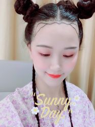 -大麦微针植发全国连锁