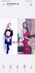 -苗塑堂减肥艾灸