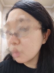 -小忠丽格医美