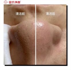 -苗坊净颜痘斑美容护肤连锁