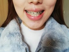 -极光口腔·矫正种植修复(锦江店)