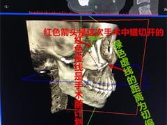 -上海仁爱医院