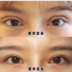 点击看大图 -南京康美美容医院·旗舰店