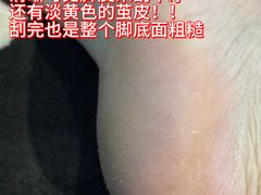 -郑远元专业修脚房(国顺东路店)