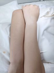 -小梨·OndaPro·专业脱毛连锁机构