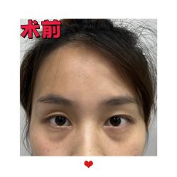 -素美医疗美容·西南眼鼻整形·修复基地