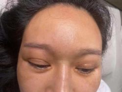 -郡艺医疗美容·微整·眼鼻吸脂