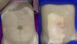 -蓝丝带产后恢复中心·催乳·通乳(渝北汽博店)