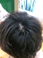 点击看大图 -雍禾植发全国连锁