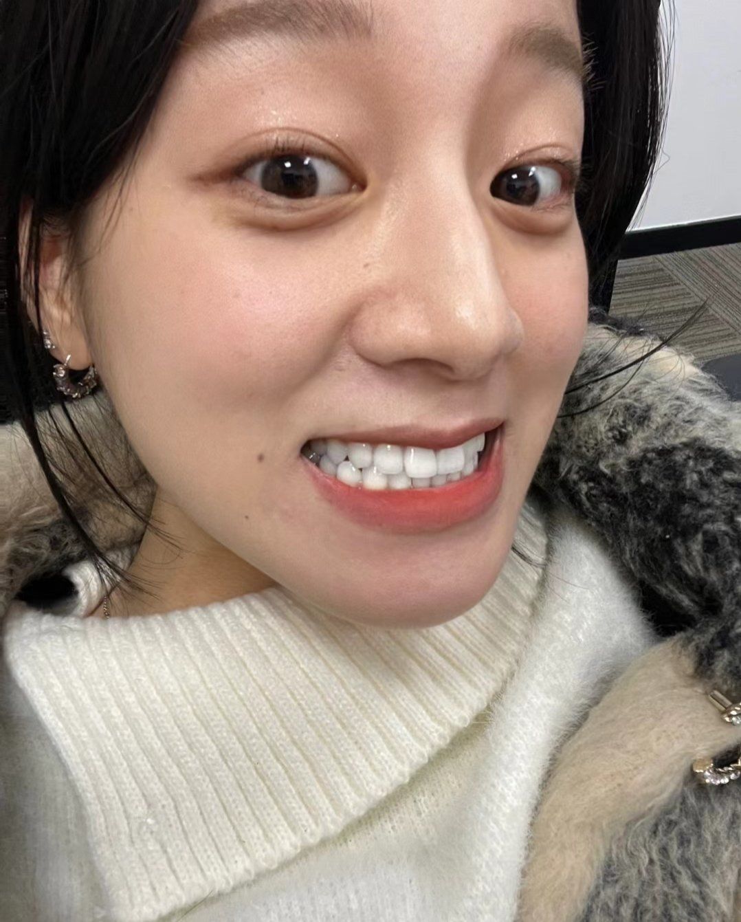 亮白牙齿自然闪耀