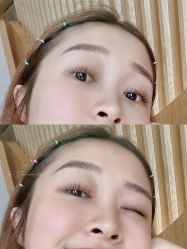 -宥莉·ULLY 痘敏肌•科技皮肤管理中心