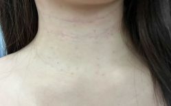 体验后-厦门美莱整形美容医院