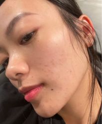 -苗方清颜痘肌研究所