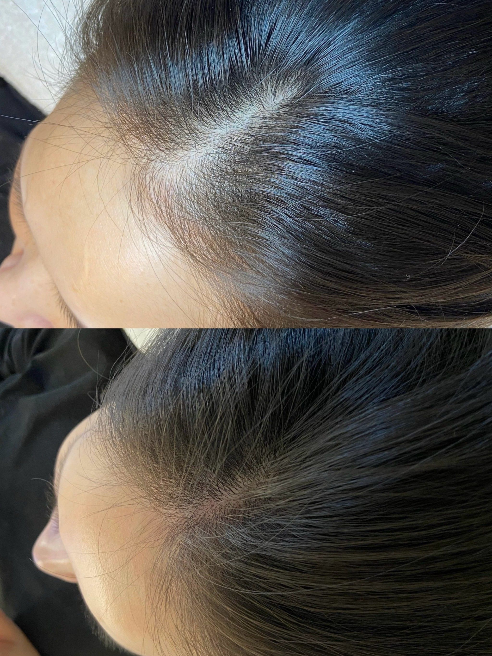 发缝宽的姐们一定要来这家店看看