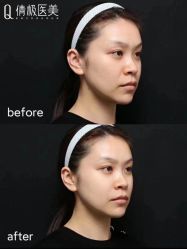 -倩极·精研痘敏肌管理