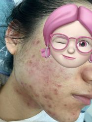 -安那般那皮肤年轻化ANAPANA