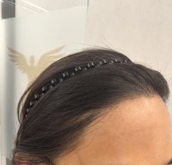 点击看大图 -熙朵美学植发·连锁品牌