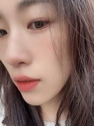 -爱小熊轻医美