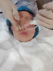 体验前-德媛医疗美容