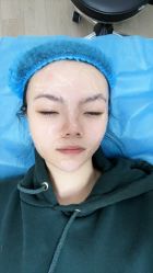 -深圳米兰柏羽医疗美容医院