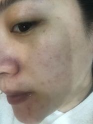 体验前-坤如玛丽·医疗美容中心