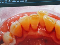-方津口腔(旺墩路店)