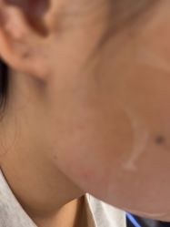 -美瑞莎创美医疗美容