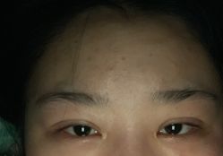-长沙雅美医疗美容医院
