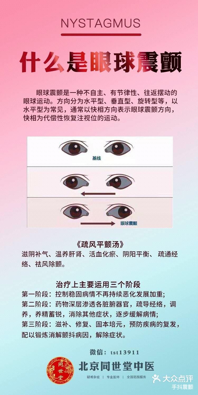 钟摆型眼球震颤症图片