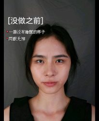 -温州伯思立医院