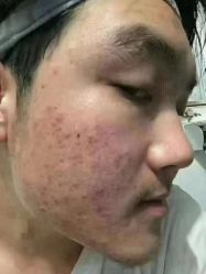 -蕾特恩专业祛痘·皮肤管理