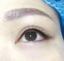 -美肤盾祛痘·问题肌头疗管理中心