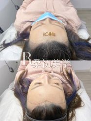 -RC半永久纹眉纹发际线