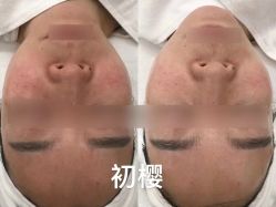-初樱科技美学问题肌修复中心