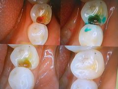 -爱贝口腔·牙周诊疗·种植修复中心