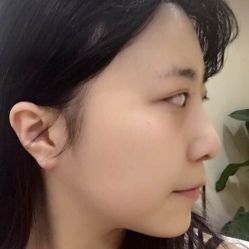 点击看大图 体验前-烟台曙光医疗美容医院