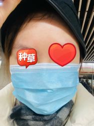 体验后-agge蛋白医美