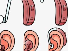 -AudioNova 海之声助听器峰力助听器索诺瓦自营店(北京店)