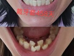 -中粮·祥云小镇