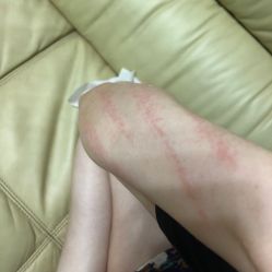 体验后-深圳广和门诊部·整形医疗美容
