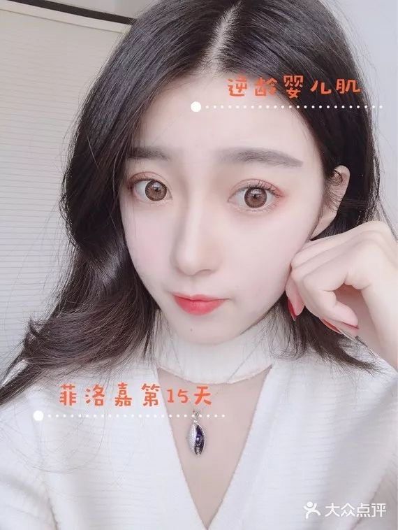 菲洛嘉号称是水光针中的“爱马仕”啊！江湖传言可以返老还童✨