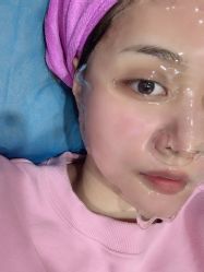 体验后-新美荟医美·专注面部美学抗衰