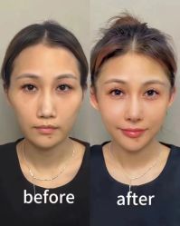 -幼泡泡连锁美容医疗