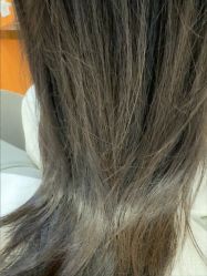 -润复丝·泽发防脱头皮管理