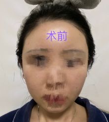 -杭州医巢医疗美容