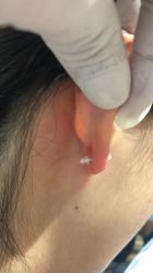 -艺耳美专业穿耳洞打耳洞穿孔