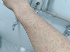 -广西壮族自治区南溪山医院