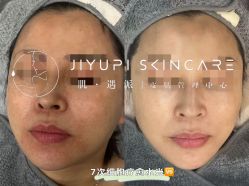 点击看大图 -MLP美丽派·问题肌疗愈中心