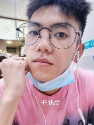 -苑苑vbeauty科技美容SPA
